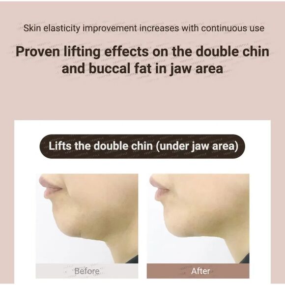 MARSHIQUE Line Lifting Hydrogel Patch - Picture 9 of 9